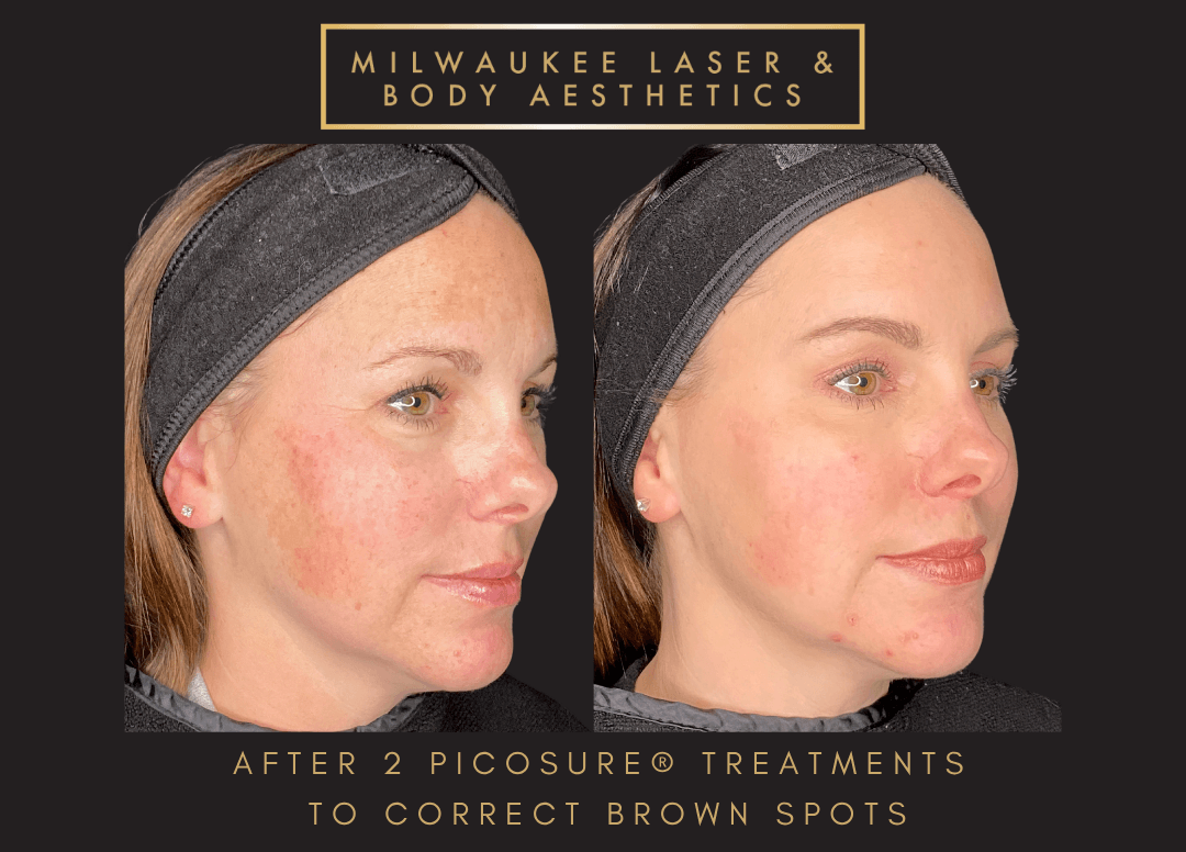 Ultimate Sun Protection