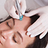 Hydrafacials